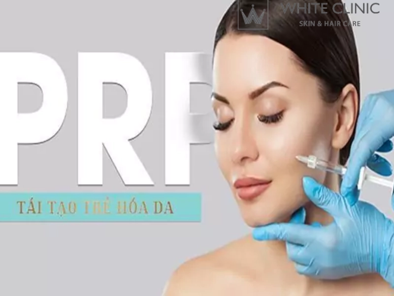 prp làm đẹp da
