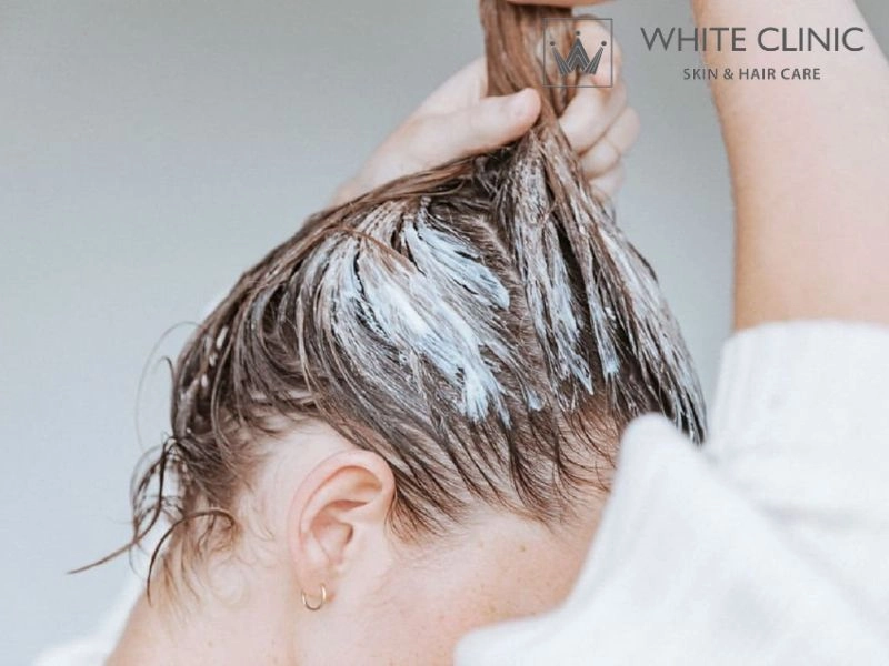 phục hồi nang tóc phục hồi nang tóc