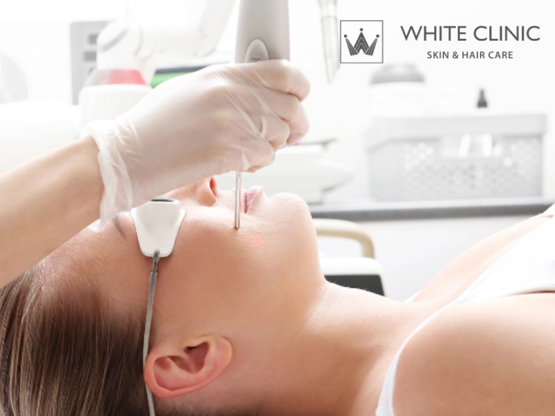 Quy trình và tiêu chí đánh giá sẹo lõm tại White Clinic Quy trình và tiêu chí đánh giá sẹo lõm tại White Clinic