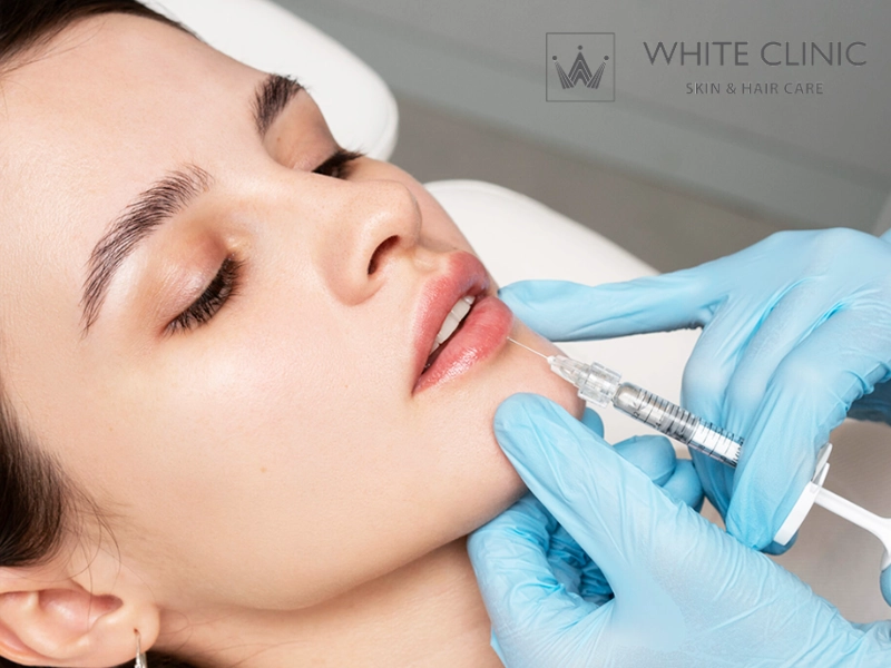 Tiêm Filler Môi: Từ Đánh Giá Cấu Trúc Đến Lựa Chọn Giải Pháp An Toàn