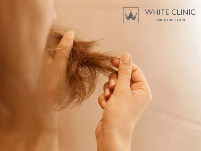 thiếu sắt có rụng tóc không