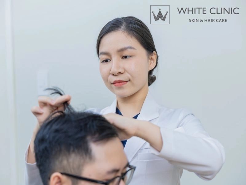 da đầu tiết nhiều dầu