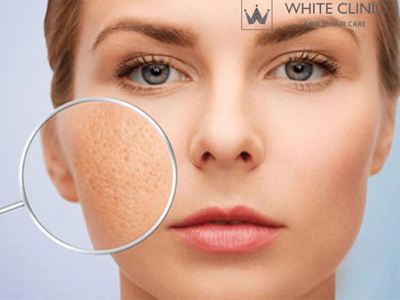 se khít lỗ chân lông se khít lỗ chân lông